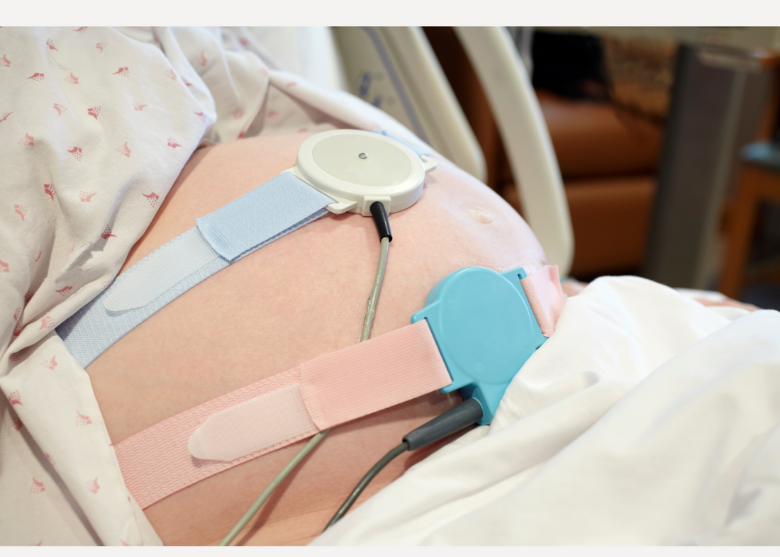 Fetal Heart Tones: What Every Nursing Student Must Know for the NCLEX